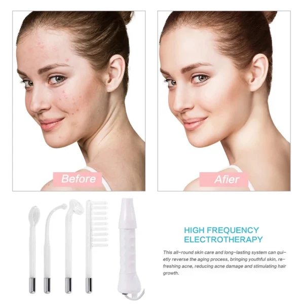 Portable High Frequency Facial Machine for Facial Skin Care and Therapy, Ideal for Home and Professional Use - Image 6
